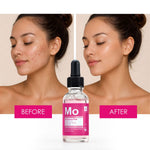 Moroccan Rose Anti-ageing Facial Oil With Hyaluronic Acid & Vitamin C 30ml For Plumping And Moisturising