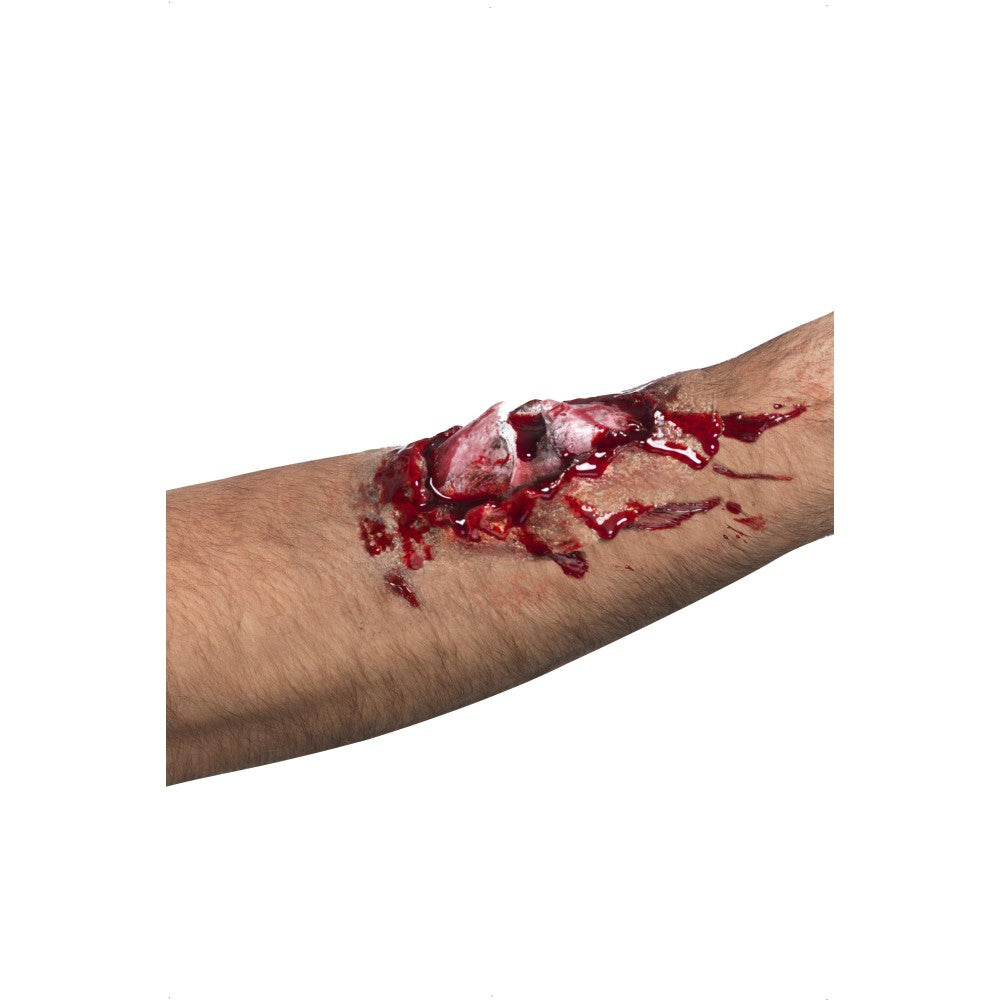 Broken Bone Scar