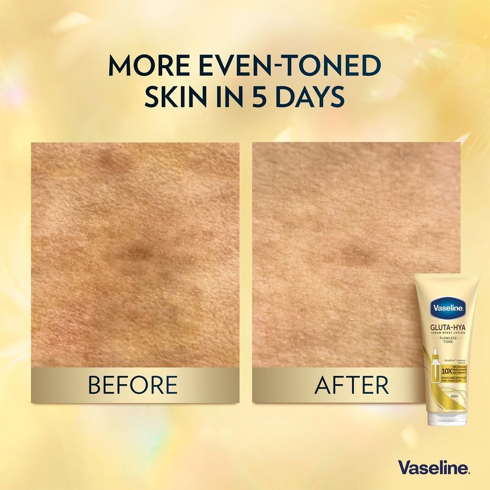Vaseline Gluta-hya Lotion Duo Dewy Radiance & Flawless Glow, 200ml Each