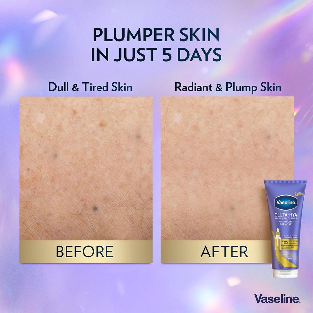 Vaseline Gluta-hya Radiance Body Lotion Duo Dewy & Overnight 200ml Each