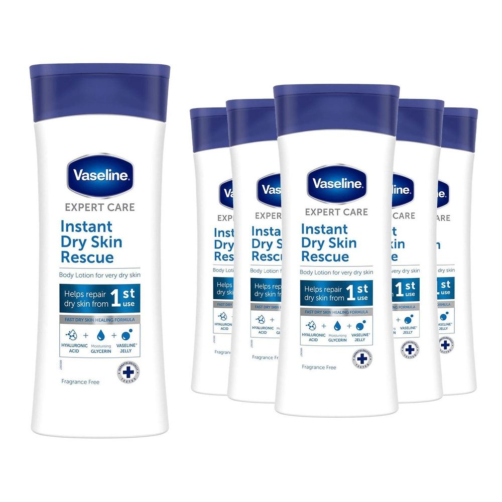Expert Care Instant Dry Skin Rescue Body Lotion For Dry Skin, 6x400ml