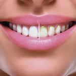 Cordless Water Flosser | White