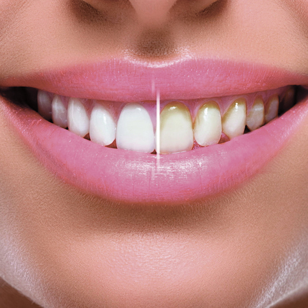 Cordless Water Flosser | White